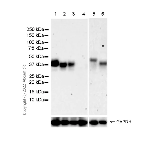 Western blot - Anti-EPCR/CD201 antibody [EPR25647-5] (AB300525)