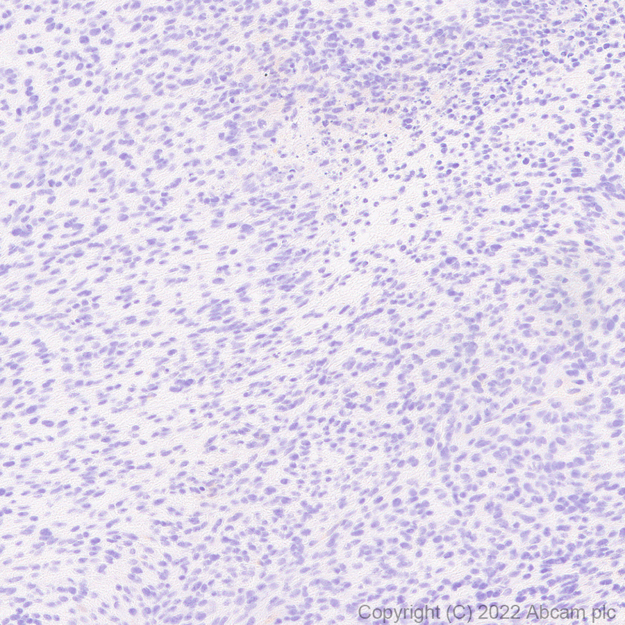 Immunohistochemistry - Anti-EPCR/CD201 antibody [EPR26267-44] (AB302911)