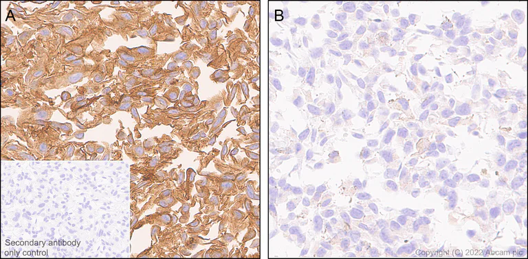 Immunohistochemistry - Anti-EPCR/CD201 antibody [EPR26267-44] - BSA and Azide free (AB302912)