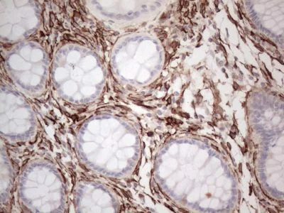 Immunohistochemistry (Formalin/PFA-fixed paraffin-embedded sections) - Anti-EPCR/CD201 antibody [OTI12H5] (AB236517)