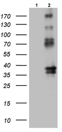 Western blot - Anti-EPCR/CD201 antibody [OTI12H5] (AB236517)