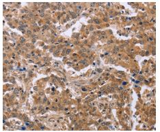 Immunohistochemistry (Formalin/PFA-fixed paraffin-embedded sections) - Anti-EPDR1 antibody - C-terminal (AB197932), expandable thumbnail