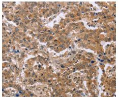 Immunohistochemistry (Formalin/PFA-fixed paraffin-embedded sections) - Anti-EPDR1 antibody - C-terminal (AB197932)