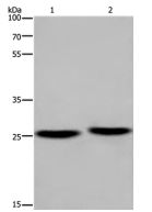 Western blot - Anti-EPDR1 antibody - C-terminal (AB197932), expandable thumbnail