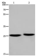 Western blot - Anti-EPDR1 antibody - C-terminal (AB197932)