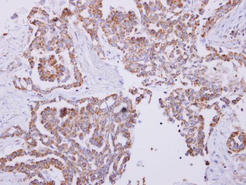 Immunohistochemistry (Formalin/PFA-fixed paraffin-embedded sections) - Anti-EPF antibody (AB227428)