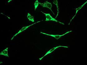 Immunocytochemistry/ Immunofluorescence - Anti-EPF antibody [EPR4476] (AB108600)