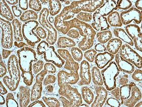 Immunohistochemistry (Formalin/PFA-fixed paraffin-embedded sections) - Anti-EPF antibody [EPR4476] (AB108600)