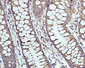 Immunohistochemistry (Formalin/PFA-fixed paraffin-embedded sections) - Anti-EPF antibody [EPR4476] (AB108600)