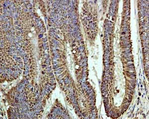 Immunohistochemistry (Formalin/PFA-fixed paraffin-embedded sections) - Anti-EPF antibody [EPR4476] (AB108600)