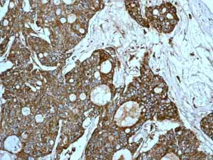 Immunohistochemistry (Formalin/PFA-fixed paraffin-embedded sections) - Anti-EPF antibody [EPR4476] (AB108600)