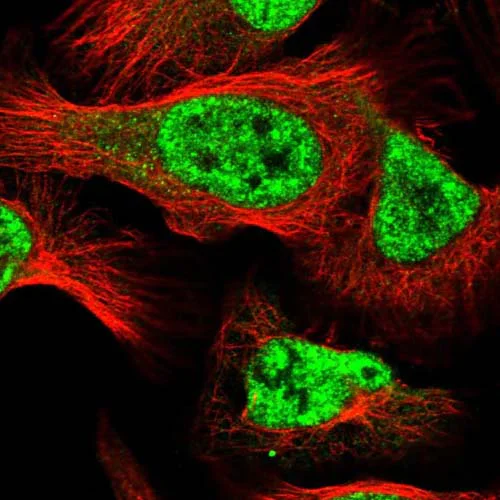 Immunocytochemistry/ Immunofluorescence - Anti-EPG5 antibody (AB122186)