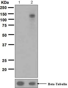 Western blot - Anti-EPH A3+A4+A5 (phospho Y779 + Y779 + Y833) antibody [EPR5684] - BSA and Azide free (AB188171)