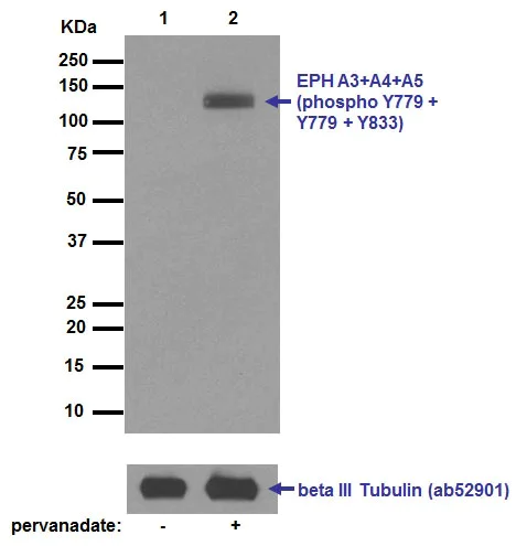 Western blot - Anti-EPH A3+A4+A5 (phospho Y779 + Y779 + Y833) antibody [EPR5684] - BSA and Azide free (AB188171)