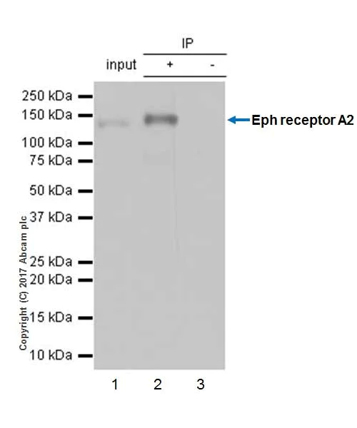 Immunoprecipitation - Anti-Eph receptor A2 antibody [EPR17660-120] (AB185156)