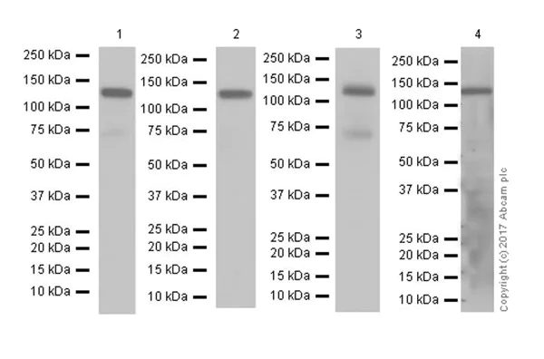 Western blot - Anti-Eph receptor A2 antibody [EPR17660-120] (AB185156)