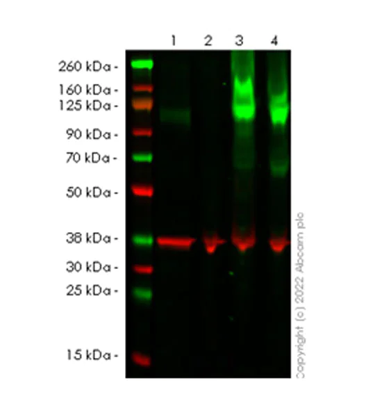 Western blot - Anti-Eph receptor A2 antibody [EPR24711-11] (AB273118)