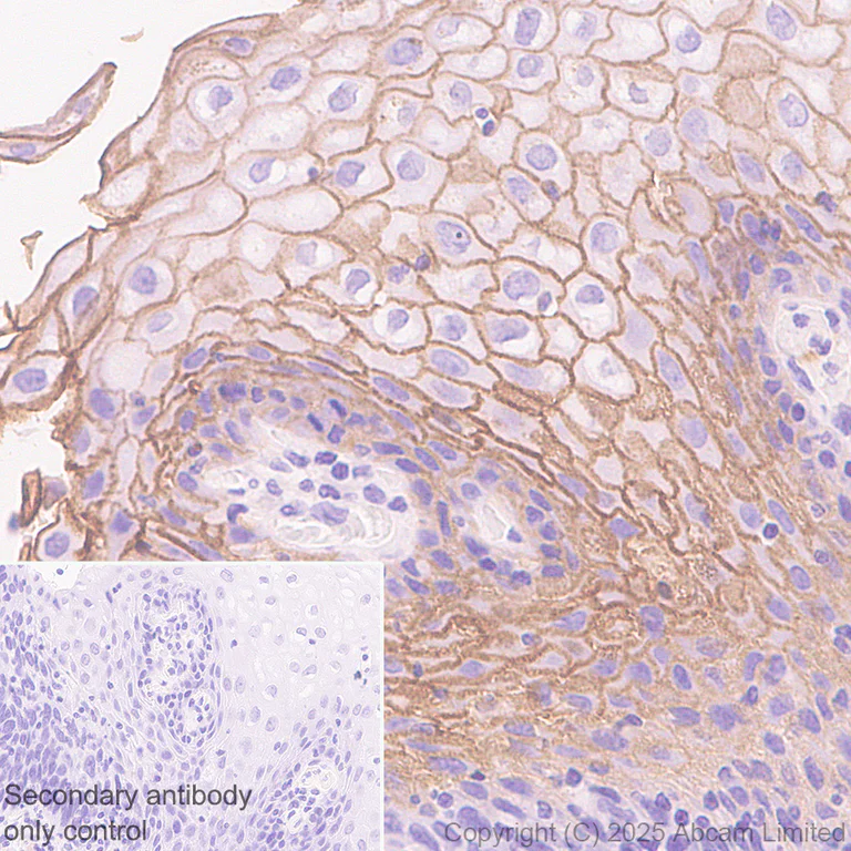 Immunohistochemistry (Formalin/PFA-fixed paraffin-embedded sections) - Anti-Eph receptor A2 antibody [EPR29732-509] (AB324955)