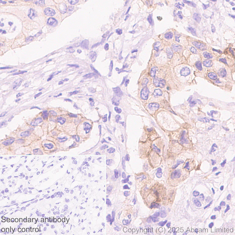 Immunohistochemistry (Formalin/PFA-fixed paraffin-embedded sections) - Anti-Eph receptor A2 antibody [EPR29732-509] (AB324955)