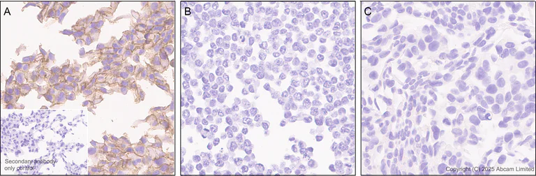 Immunohistochemistry (Formalin/PFA-fixed paraffin-embedded sections) - Anti-Eph receptor A2 antibody [EPR29732-509] (AB324955)