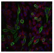Immunocytochemistry/ Immunofluorescence - Anti-Eph receptor A2 antibody [Ka-5H5] (AB59551)