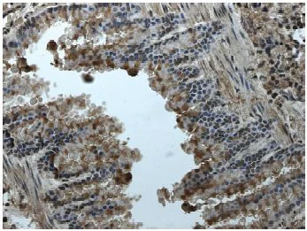 Immunohistochemistry (Formalin/PFA-fixed paraffin-embedded sections) - Anti-Eph receptor A2 antibody [RM-0051-8F21] (AB73254)