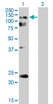 Western blot - Eph receptor A2 overexpression 293T lysate (whole cell) (AB94109), expandable thumbnail
