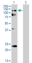 Western blot - Eph receptor A2 overexpression 293T lysate (whole cell) (AB94109)
