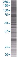 Eph receptor A2 overexpression 293T lysate (whole cell)