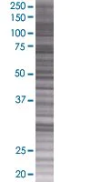 SDS-PAGE - Eph receptor A2 overexpression 293T lysate (whole cell) (AB94110)
