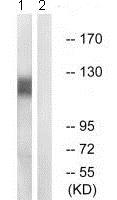 Western blot - Anti-Eph receptor A2+A3+A4 antibody (AB196899), expandable thumbnail