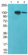 Western blot - Anti-Eph receptor A2+A3+A4 antibody (AB196899), expandable thumbnail