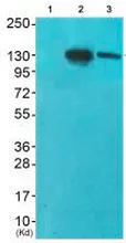 Western blot - Anti-Eph receptor A2+A3+A4 antibody (AB196899)