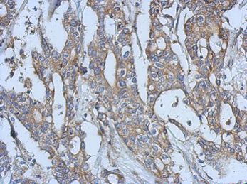 Immunohistochemistry (Formalin/PFA-fixed paraffin-embedded sections) - Anti-Eph receptor A3 antibody (AB126261)