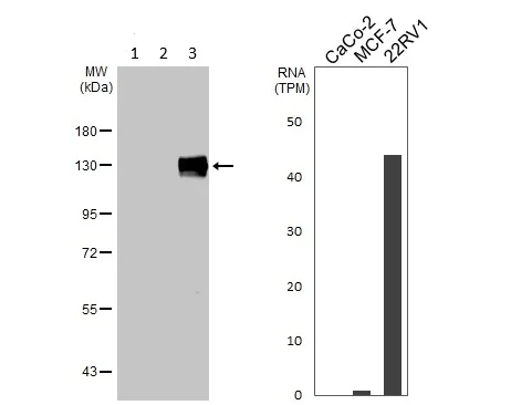 Western blot - Anti-Eph receptor A3 antibody (AB126261)
