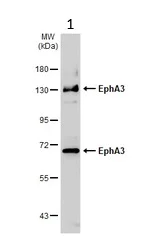 Western blot - Anti-Eph receptor A3 antibody (AB126261)