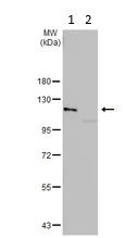 Western blot - Anti-Eph receptor A3 antibody (AB126261)