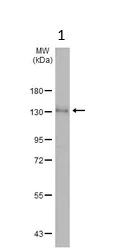 Western blot - Anti-Eph receptor A3 antibody (AB126261)