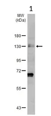 Western blot - Anti-Eph receptor A3 antibody (AB126261)