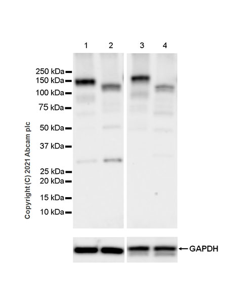 Western blot - Anti-Eph receptor A3 antibody [EPR24479-136] (AB281926)