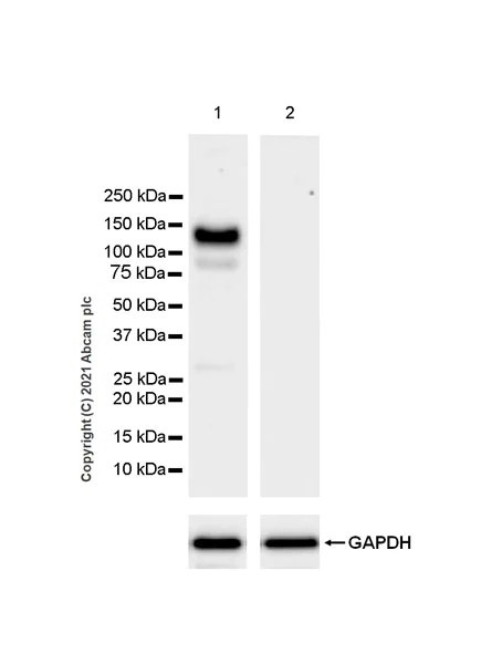 Western blot - Anti-Eph receptor A3 antibody [EPR24479-136] - BSA and Azide free (AB281946)