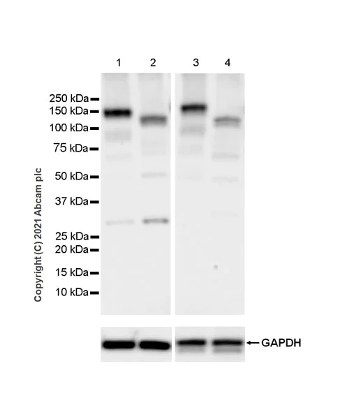 Western blot - Anti-Eph receptor A3 antibody [EPR24479-136] - BSA and Azide free (AB281946)