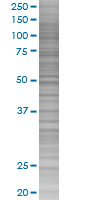 Eph receptor A3 overexpression 293T lysate (whole cell)