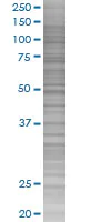 SDS-PAGE - Eph receptor A3 overexpression 293T lysate (whole cell) (AB94111)