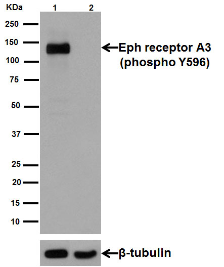 Western blot - Anti-Eph receptor A3 (phospho Y596) antibody [EPR3434(N)] (AB191565)