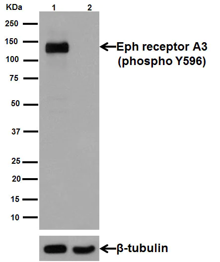 Western blot - Anti-Eph receptor A3 (phospho Y596) antibody [EPR3434(N)] (AB191565)