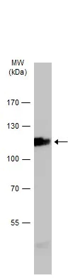 Western blot - Anti-Eph receptor A4/SEK antibody (AB262707)