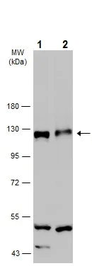 Western blot - Anti-Eph receptor A4/SEK antibody (AB262707)