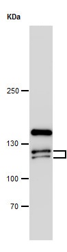 Western blot - Anti-Eph receptor A4/SEK antibody (AB262707)