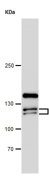 Western blot - Anti-Eph receptor A4/SEK antibody (AB262707)